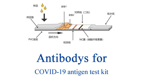 COVID-19 için antikor antijen testi