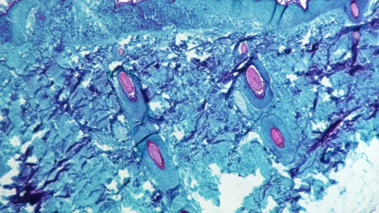 Monkeypox A29L, A35R antikor çifti ve kesilmemiş levha şimdi mevcuttur! Pico-LFA üzerinde gram hassasiyet elde edilebilir.